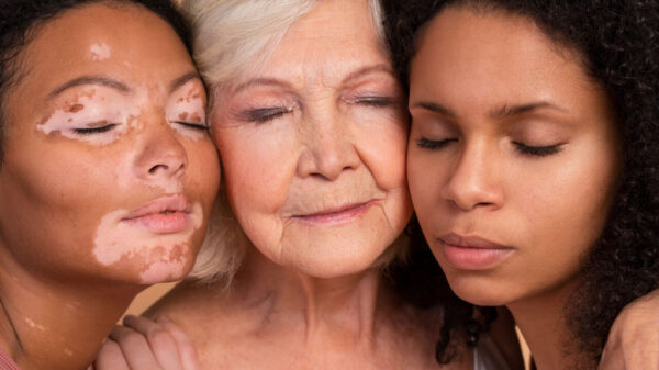 L'Oréal Act for Dermatology - Divulgação